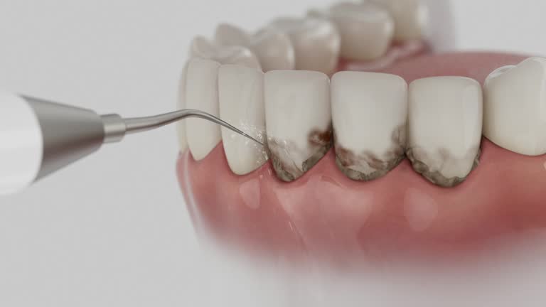 Reliable Dental contractor in Cloverdale, CA by Smile Center Dentistry